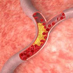 what are phytosterols